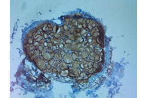 IHC on paraffin sections of rat DRG using Rabbit antibody to TrkC .