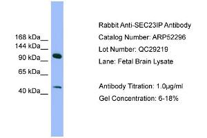 WB Suggested Anti-SEC23IP  Antibody Titration: 0. (SEC23IP anticorps  (N-Term))