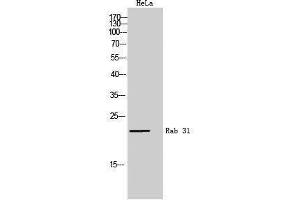 Western Blotting (WB) image for anti-RAB31, Member RAS Oncogene Family (RAB31) (Internal Region) antibody (ABIN3177069) (RAB31 anticorps  (Internal Region))