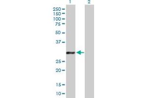 Western Blot analysis of GCLM expression in transfected 293T cell line by GCLM MaxPab polyclonal antibody. (GCLM anticorps  (AA 1-274))