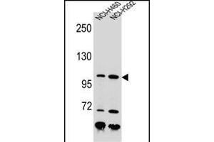 NBN Antibody (C-term) (ABIN655721 and ABIN2845169) western blot analysis in NCI-,NCI- cell line lysates (35 μg/lane). (Nibrin anticorps  (C-Term))