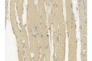 ABIN6261483 and ABIN6273237 at 1/100 staining human tongue carcinoma by IHC-P.
