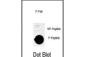 Dot blot analysis of anti-Phospho-AKT1 (Thr308) Antibody Phospho-specific Pab (ABIN650880 and ABIN2839823) on nitrocellulose membrane. (AKT1 anticorps  (pThr308))