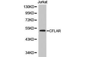 Western Blotting (WB) image for anti-CASP8 and FADD-Like Apoptosis Regulator (CFLAR) antibody (ABIN1871811) (FLIP anticorps)
