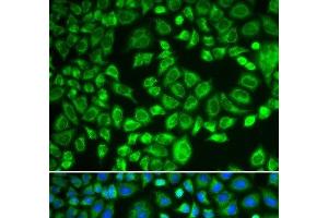 Immunofluorescence analysis of MCF-7 cells using PSMD7 Polyclonal Antibody (PSMD7 anticorps)