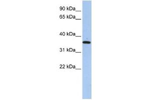 Western Blotting (WB) image for anti-Family with Sequence Similarity 84, Member A (FAM84A) antibody (ABIN2459583) (FAM84A anticorps)