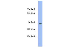 Human kidney; WB Suggested Anti-ACMSD Antibody Titration: 0. (ACMSD anticorps  (Middle Region))