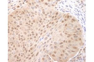 Immunohistochemistry (IHC) image for anti-Cell Division Cycle 6 Homolog (S. Cerevisiae) (CDC6) (AA 1-50) antibody (ABIN7453498)