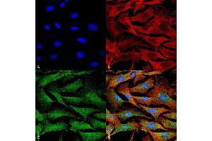 Immunocytochemistry/Immunofluorescence analysis using Mouse Anti-Copper Transporting ATPase 1 Monoclonal Antibody, Clone S60-4 . (ATP7A anticorps  (AA 42-61) (Atto 594))