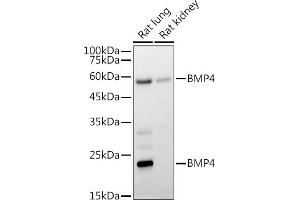 Western blot analysis of extracts of various cell lines, using BMP4 antibody (ABIN6127497, ABIN6137600, ABIN6137603 and ABIN6215157) at 1:1000 dilution. (BMP4 anticorps  (AA 1-408))