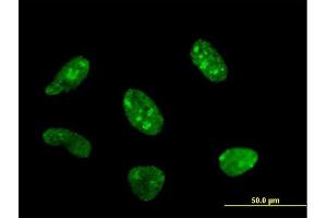 Immunofluorescence of monoclonal antibody to POLR1C on HeLa cell. (POLR1C anticorps  (AA 1-346))