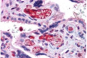 Human Placenta: Formalin-Fixed, Paraffin-Embedded (FFPE)