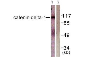 Western Blotting (WB) image for anti-Catenin (Cadherin-Associated Protein), delta 1 (CTNND1) (Tyr228) antibody (ABIN1848016) (CTNND1 anticorps  (Tyr228))
