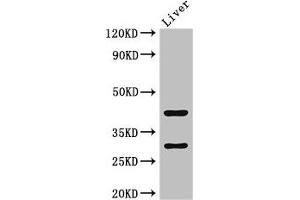 Western Blot Positive WB detected in: Mouse liver tissue All lanes: TIMD4 antibody at 2 μg/mL Secondary Goat polyclonal to rabbit IgG at 1/50000 dilution Predicted band size: 42, 39 kDa Observed band size: 42, 30 kDa (TIMD4 anticorps  (AA 134-301))
