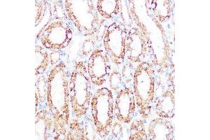 Immunohistochemistry of paraffin-embedded mouse kidney using DLDH/DLD Rabbit mAb (ABIN7266766) at dilution of 1:100 (40x lens). (DLD anticorps)