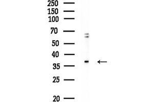 anti-Cyclin-Dependent Kinase 7 (CDK7) (Internal Region) antibody