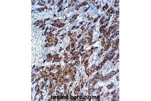 Immunohistochemistry (IHC) image for anti-Galectin 3 (LGALS3) antibody (ABIN2995387) (Galectin 3 anticorps)