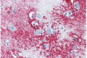 Anti-APC antibody IHC staining of human brain, cortex.