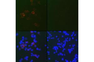 anti-SARS-CoV-2 Nucleocapsid (SARS-CoV-2 N) antibody