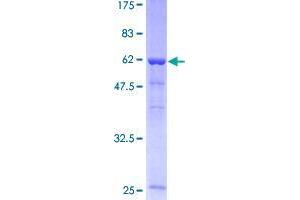 Image no. 1 for Serine/threonine Kinase Receptor Associated Protein (STRAP) (AA 1-350) protein (GST tag) (ABIN1321751)