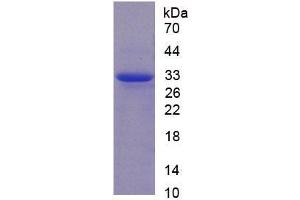 SDS-PAGE (SDS) image for Calpain 1 (CAPN1) (AA 75-356) protein (His tag) (ABIN1169980)