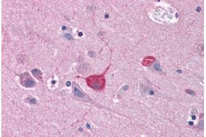 Human Brain, Cortex: Formalin-Fixed, Paraffin-Embedded (FFPE)