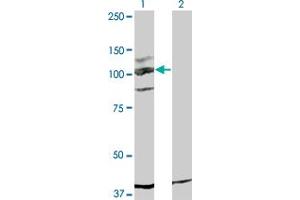 Western Blot analysis of KIT expression in transfected 293T cell line by KIT monoclonal antibody (M05), clone 5F6. (KIT anticorps  (AA 41-140))