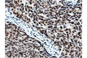 Immunohistochemical staining of paraffin-embedded Human Kidney tissue using anti-NT5DC1 mouse monoclonal antibody.