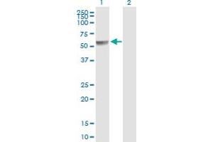 Western Blot analysis of PPP2R5A expression in transfected 293T cell line by PPP2R5A MaxPab polyclonal antibody. (PPP2R5A anticorps  (AA 1-486))