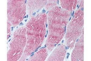 Anti-ARL6 antibody IHC of human skeletal muscle. (ARL6 anticorps  (N-Term))