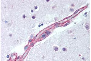 Brain, cortex, capillary (JNK2 anticorps  (AA 373-389))