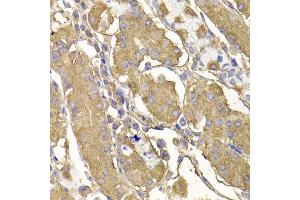 Immunohistochemistry of paraffin-embedded human stomach using RASGRF1 antibody (ABIN5974188) at dilution of 1/100 (40x lens). (RASGRF1 anticorps)