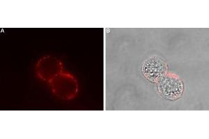 Expression of SSTR2 in human HT-29 cells - Cell surface detection of SSTR2 in intact living human colorectal adenocarcinoma (HT-29) cells.