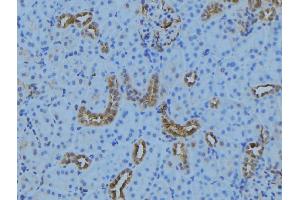 ABIN6279279 at 1/100 staining Mouse kidney tissue by IHC-P.