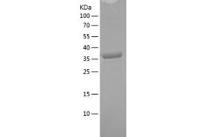 Western Blotting (WB) image for Beclin 1, Autophagy Related (BECN1) (AA 46-152) protein (His-IF2DI Tag) (ABIN7121991)