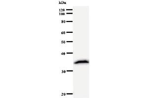 Western Blotting (WB) image for anti-Ribonuclease P/MRP 30kDa Subunit (RPP30) antibody (ABIN933123)
