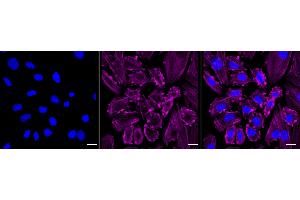 anti-Myosin, Light Chain 12B, Regulatory (MYL12B) antibody