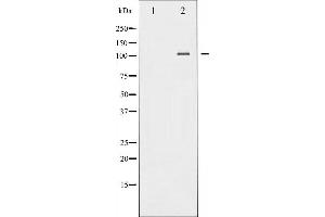 Western blot analysis of NF- kappaB p100/p52 phosphorylation expression in TNF-α treated MDA-MB-435 whole cell lysates,The lane on the left is treated with the antigen-specific peptide.