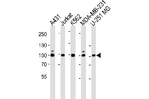 Western blot analysis of lysates from A431, Jurkat, K562, MDA-MB-231, U-251 MG cell line (from left to right), using ZN Antibody (N-term) (ABIN1944760 and ABIN2838552). (ZNF175 anticorps  (N-Term))