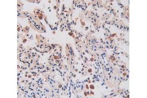 IHC-P analysis of lung tissue, with DAB staining. (IL17RA anticorps  (AA 377-534))