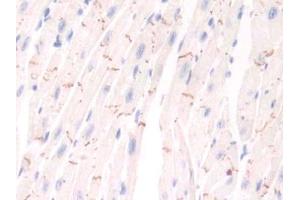 DAB staining on IHC-P; Samples: Mouse Cardiac Muscle Tissue (PIM1 anticorps  (AA 122-261))