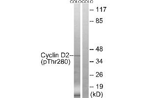 Western blot analysis of extracts from COLO cells, treated with EGF (200ng/ml, 30mins), using Cyclin D2 (Phospho-Thr280) antibody. (Cyclin D2 anticorps  (pThr280))