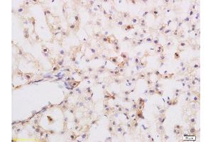 Formalin-fixed and paraffin embedded rat liver labeled with Rabbit Anti-Substance P Polyclonal Antibody at 1:200 followed by conjugation to the secondary antibody and DAB staining.