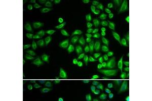 Immunofluorescence analysis of MCF-7 cells using PTPN1 Polyclonal Antibody (PTPN1 anticorps)