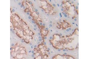 Used in DAB staining on fromalin fixed paraffin- embedded kidney tissue (DPEP2 anticorps  (AA 303-486))