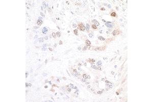 Immunohistochemistry (IHC) image for anti-Nicotinamide phosphoribosyltransferase (NAMPT) (AA 400-450) antibody (ABIN7454014) (Recombinant NAMPT anticorps  (AA 400-450))