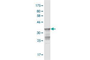 Western Blot detection against Immunogen (36. (STAR anticorps  (AA 81-180))