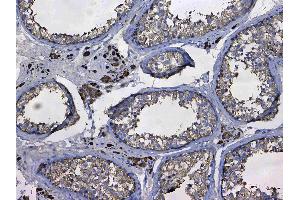 IHC analysis of GSTM3 using anti-GSTM3 antibody .