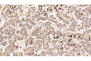 Detection of PRL in Porcine Pituitary Tissue using Polyclonal Antibody to Prolactin (PRL)
