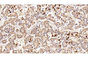 Detection of PRL in Porcine Pituitary Tissue using Polyclonal Antibody to Prolactin (PRL) (Prolactin anticorps  (AA 31-229))